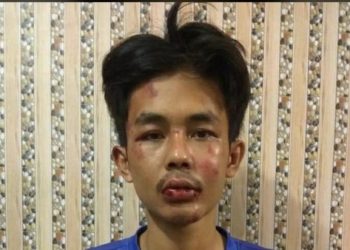 Polisi Tak Temukan Bukti Radikalisme pada Kasus Penusukan Syech Ali Jaber