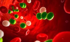 Sepsis
